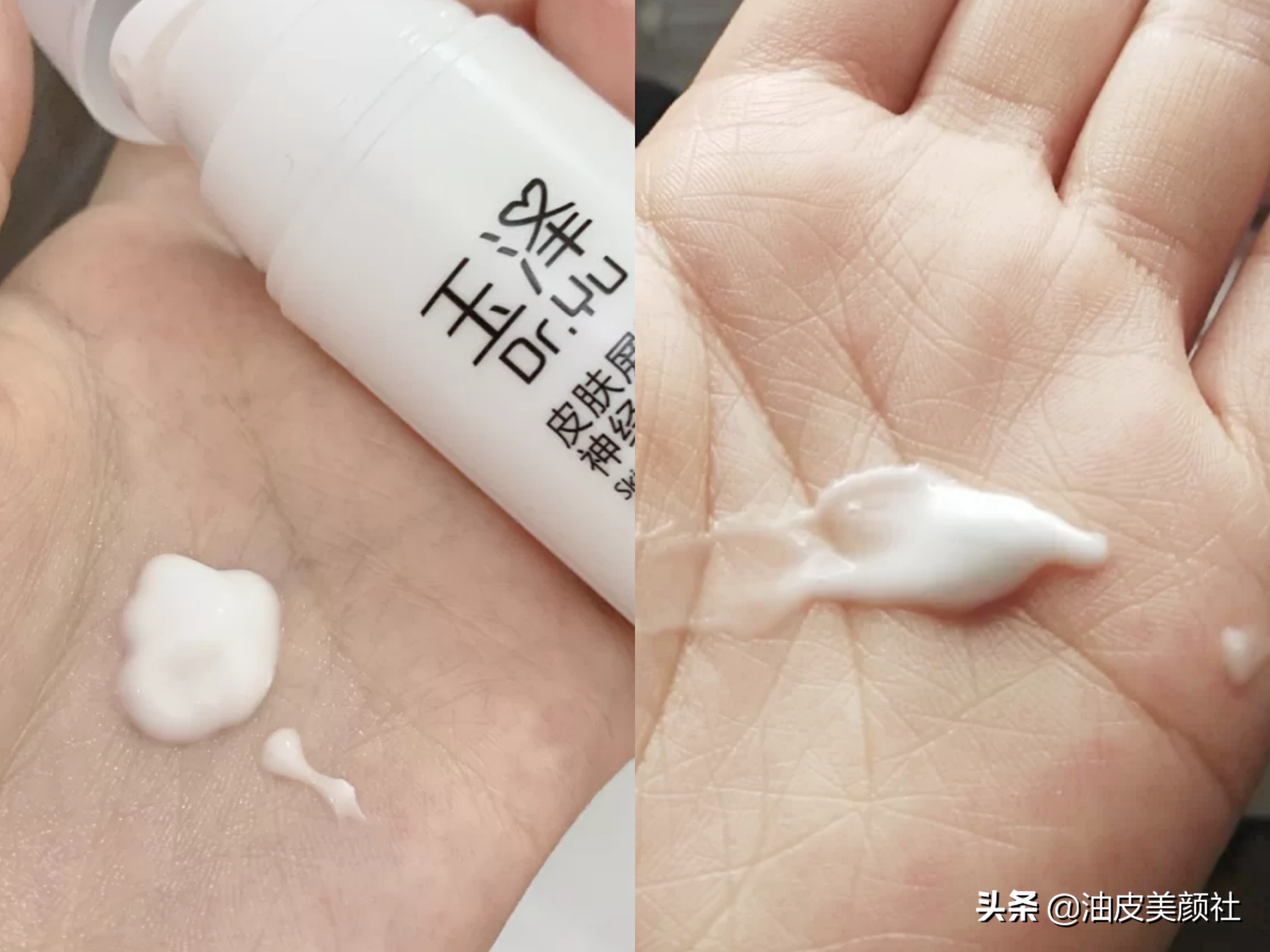 脸上长痘痘用什么护肤品比较好(针对痘痘肌的护肤品排行榜)