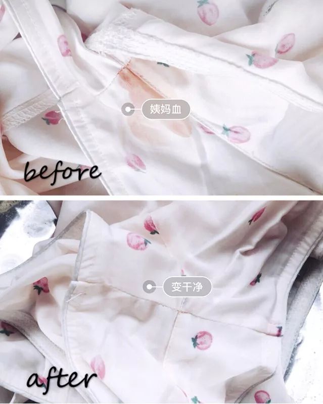 衣服洗完以后发黄这是为什么呢(衣服发黄正确的处理方法和技巧) 衣服洗完以后发黄这是为什么呢(衣服发黄正确的处理方法和技巧)