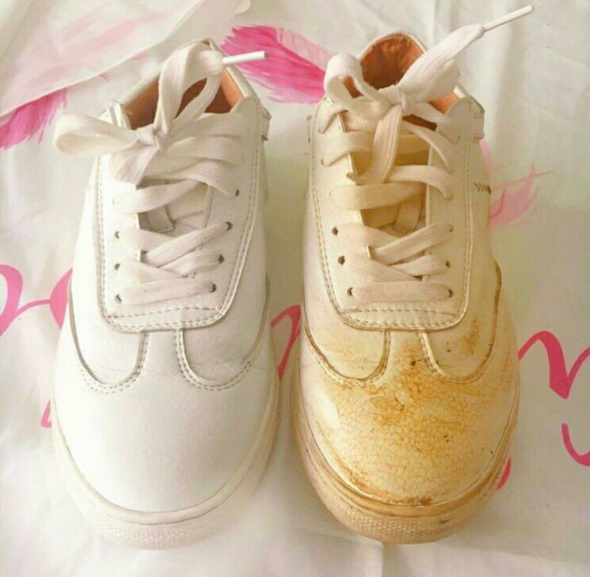 衣服洗完以后发黄这是为什么呢(衣服发黄正确的处理方法和技巧) 衣服洗完以后发黄这是为什么呢(衣服发黄正确的处理方法和技巧)