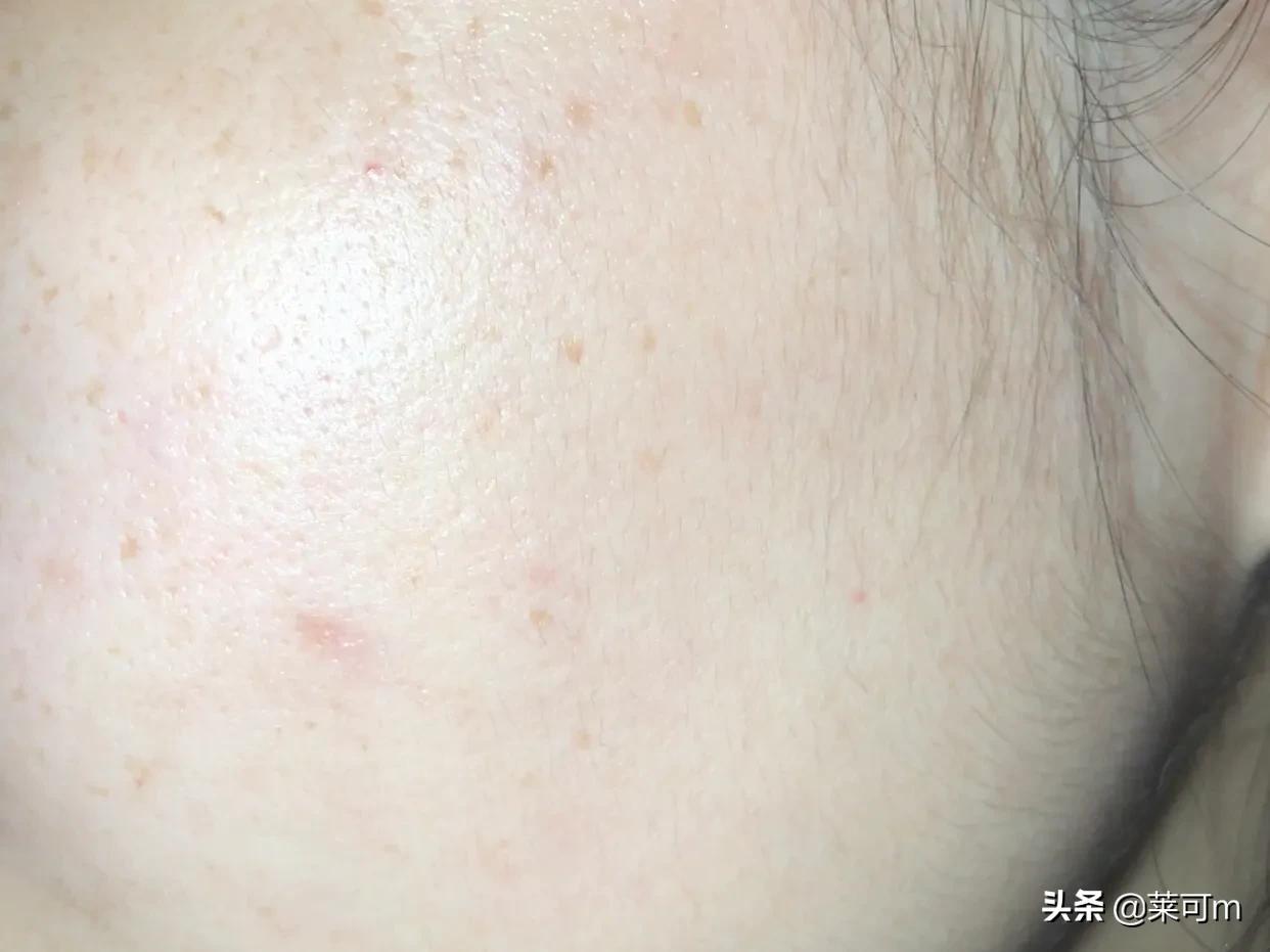 刷酸怎么刷 新手刷酸步骤 刷酸怎么刷 新手刷酸步骤