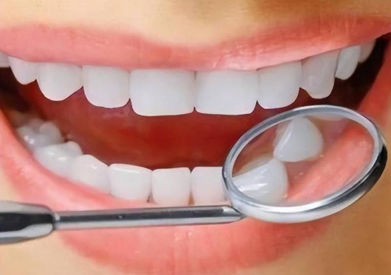 冲牙器能替代电动牙刷吗？冲牙器对牙齿的危害