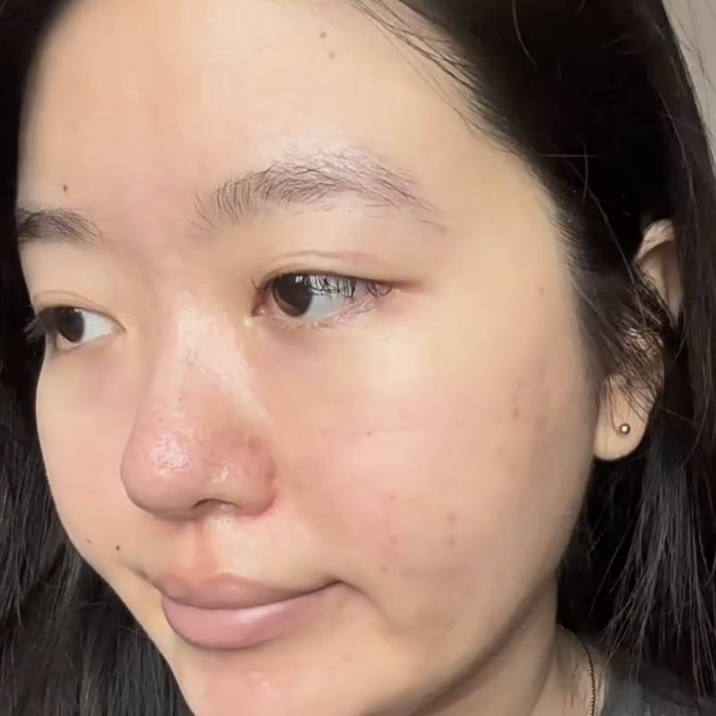 美加净仙米瓶精华好用吗？美加净仙米瓶精华怎么样？